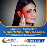 ACupuncture Treatment For Trigeminal Neuralgia in Chennai, Chennai Jayanth Acupuncture Clinic, Koyabedu