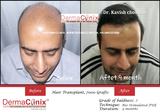  DermaClinix - The Complete Skin & Hair Solution Center E-13, Basement, Defence Colony, Near Andrews Ganj Bus Stop, New Delhi 