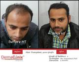  DermaClinix - The Complete Skin & Hair Solution Center E-13, Basement, Defence Colony, Near Andrews Ganj Bus Stop, New Delhi 