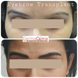  DermaClinix - The Complete Skin & Hair Solution Center E-13, Basement, Defence Colony, Near Andrews Ganj Bus Stop, New Delhi 