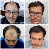 DermaClinix - The Complete Skin & Hair Solution Center, Delhi