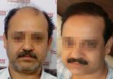 DermaClinix - The Complete Skin & Hair Solution Center, Delhi