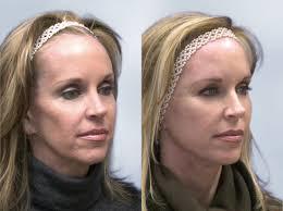  New Album of Gambhir Cosmetic Medicine 668 W Lincoln Hwy, - Photo 5 of 6