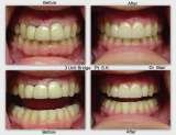 Dr Donna J Blair Neuromuscular Dentist, Fresno