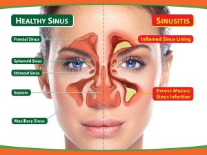 sinus surgery  of AllergyDoc 909, Sector- 31 - Photo 2 of 3