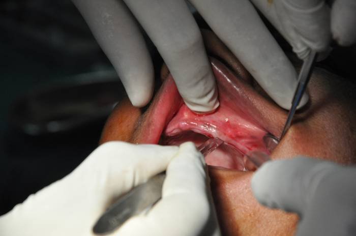 dental Implantology<br />
certified courses  New Album of Indian dental academy -Fixed orthodontics & Implant training center ameerpet - Photo 6 of 6