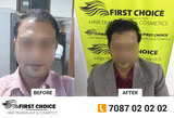 First Choice Hair Transplant & Cosmetics, Ludhiana