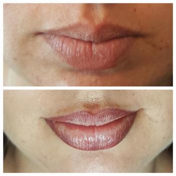  New Album of The Fine Line Permanent Cosmetics 701 NW Federal Hwy, 102 - Photo 2 of 3
