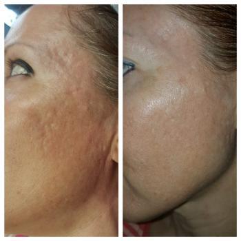  New Album of The Fine Line Permanent Cosmetics 701 NW Federal Hwy, 102 - Photo 3 of 3