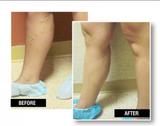 USA Vein Clinics, Elk Grove Village