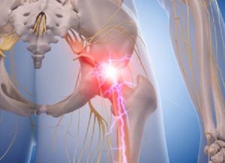 sciatica-nerve-treatment-alaska Profile Photos of Better Health Chiropractic & Physical Rehab 8840 Old Seward Hwy Suite E - Photo 7 of 21