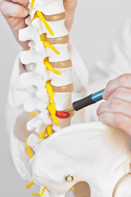 herniated disc-back pain Profile Photos of Better Health Chiropractic & Physical Rehab 8840 Old Seward Hwy Suite E - Photo 14 of 21