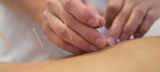 Julie Betts Acupuncture, Braintree