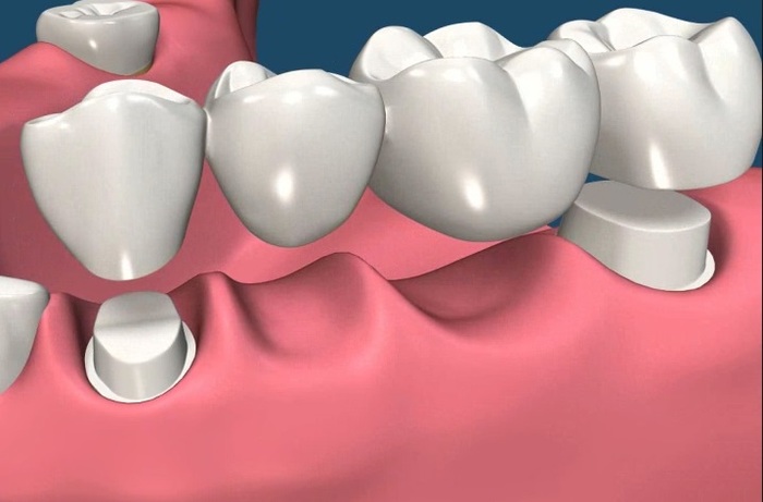  Profile Photos of CareWay Dental 1800 Justin Rd. - Photo 4 of 9