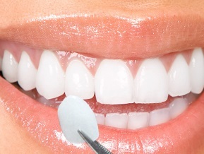  Profile Photos of CareWay Dental 1800 Justin Rd. - Photo 5 of 9