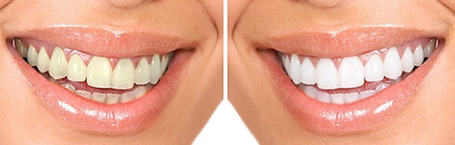  Profile Photos of CareWay Dental 1800 Justin Rd. - Photo 6 of 9