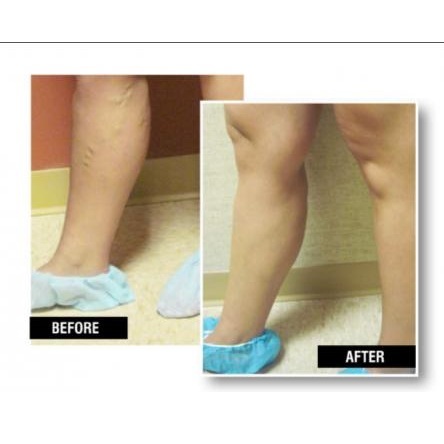  Profile Photos of USA Vein Clinics 280 Union St, Ste 401 - Photo 4 of 4