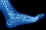 Lake Pointe Foot & Ankle: Martin V. Sloan, DPM, Rockwall