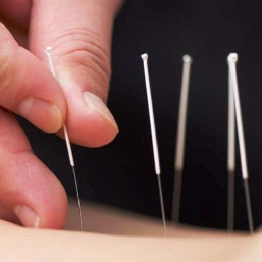  Profile Photos of A-Care Acupuncture & Health Center 55 S Abbott Ave - Photo 4 of 5