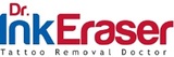 Birmingham Tattoo Removal, Birmingham