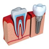 Dental Veneers & Lumineers, Brooklyn