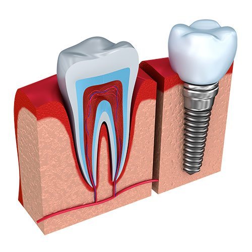  Pricelists of Dental Veneers & Lumineers 1603 McDonald Ave #345 - Photo 1 of 4