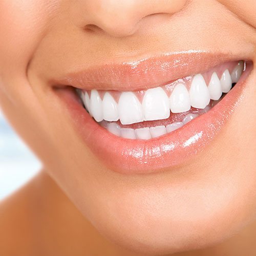 Pricelists of Dental Veneers & Lumineers 1603 McDonald Ave #345 - Photo 2 of 4