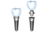  The Center for High Tech Dentistry - Dr. Simon W. Rosenberg DMD 399 E 72nd St., Suite #1A 