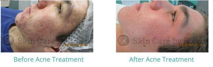  Profile Photos of Skin Care by Robyn 9220 Teddy Ln Suite 1200 - Photo 1 of 4
