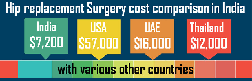  Pricelists of Low Cost Hip Replacement Surgery India Ajanta Sea Breeze Society, Sector 14, Airoli,  Navi Mumbai, Maharashtra 400708, India - Photo 1 of 1