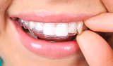 Apple Dental Care, Edmonton
