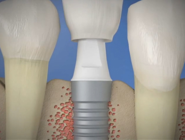  Profile Photos of Houston Dental Esthetics 14511 Old Katy Rd. Ste 180 - Photo 4 of 4