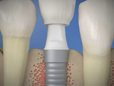  Houston Dental Esthetics 14511 Old Katy Rd. Ste 180 