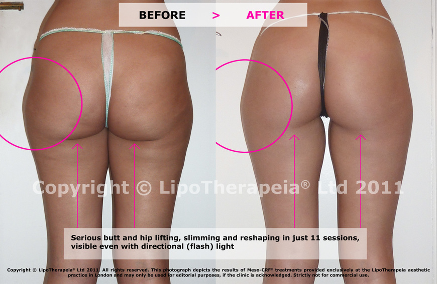  Pricelists of Sculpted Contours Luxury Medical Aesthetics 550 Pharr Rd NE #630 - Photo 3 of 6