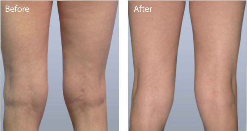  Pricelists of Sculpted Contours Luxury Medical Aesthetics 550 Pharr Rd NE #630 - Photo 4 of 6