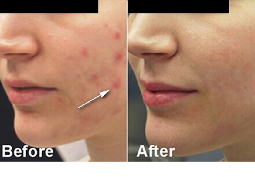  Pricelists of Sculpted Contours Luxury Medical Aesthetics 550 Pharr Rd NE #630 - Photo 5 of 6