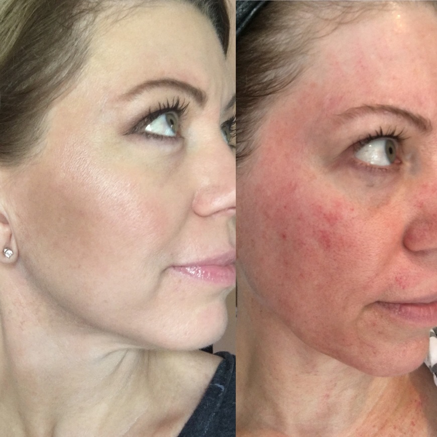  Pricelists of Sculpted Contours Luxury Medical Aesthetics 550 Pharr Rd NE #630 - Photo 6 of 6