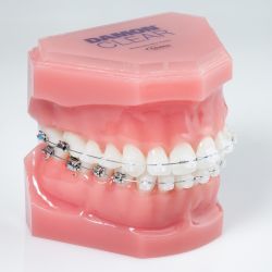  Profile Photos of Beam Orthodontics 36 S Tay St - Photo 4 of 8