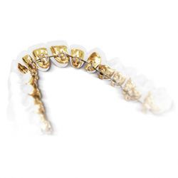  Profile Photos of Beam Orthodontics 36 S Tay St - Photo 5 of 8