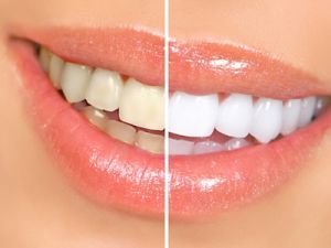  Profile Photos of The Brace Place 2 Albert Rd, Cross Hills - Photo 3 of 4