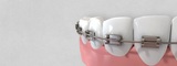  Palo Alto Orthodontics 905 Middlefield Rd., Suite A 