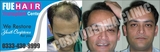 Cosmo Hair transplant Clinic Lahore, Lahore