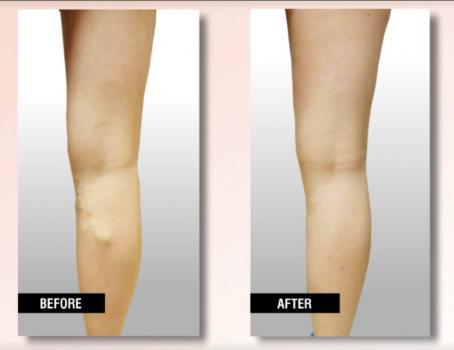  Profile Photos of USA Vein Clinics 4159 Broadway - Photo 2 of 4