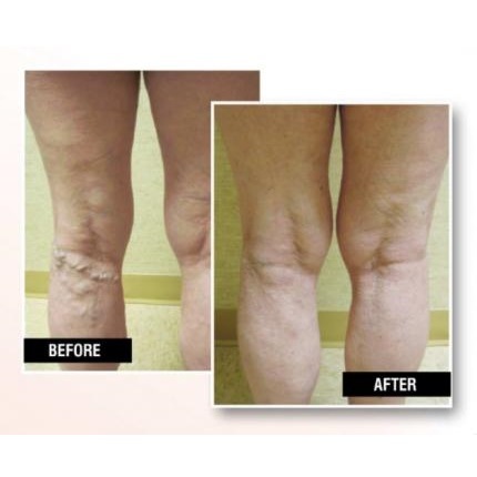  Profile Photos of USA Vein Clinics 333 W 89th Ave, Ste W-2 - Photo 3 of 4