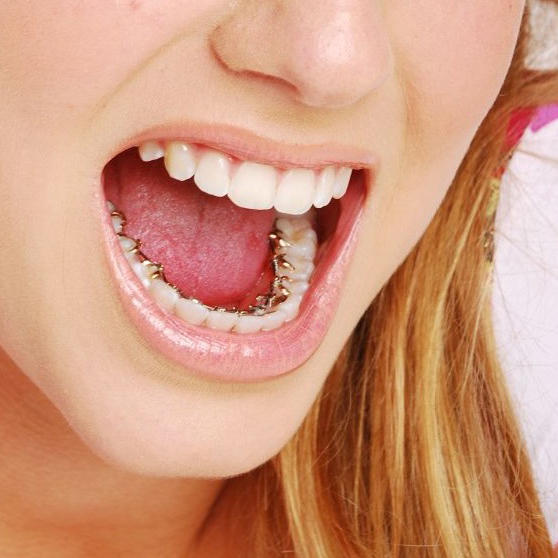  Profile Photos of The Forum Orthodontics Vanessa Drive - Photo 5 of 7