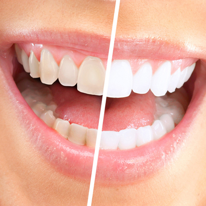  Profile Photos of The Forum Orthodontics Vanessa Drive - Photo 6 of 7