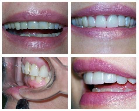  Profile Photos of Beacon Cove Dental Group Suite 6A, 105 Beach Street - Photo 5 of 10