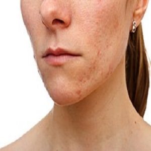  New Album of Midtown Dermatology 51 East 25th Street, suite 813D - Photo 3 of 5