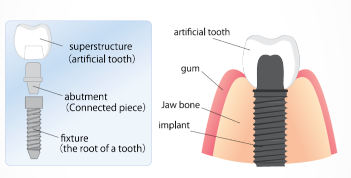  Profile Photos of Lifestyle Dental and Implant Clinic 284 Garstang Road - Photo 2 of 4
