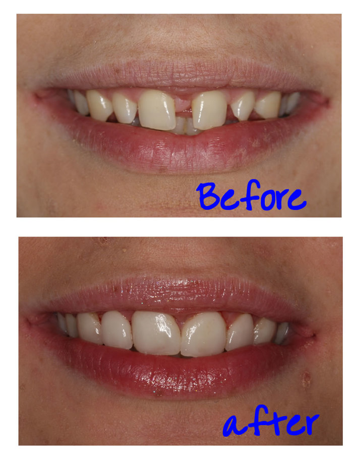  Profile Photos of Lifestyle Dental and Implant Clinic 284 Garstang Road - Photo 3 of 4